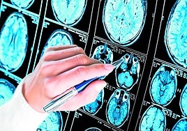 Pruebas de imagen de cerebros, en una imagen de archivo.