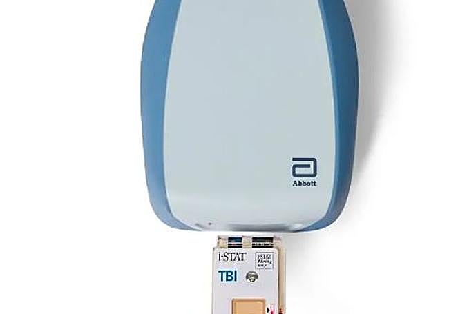 Análisis de sangre para lesiones cerebrales