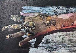 El anillo inteligente destapó que la víctima, con graves quemaduras, llevaba ya horas muerta.