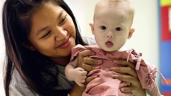 El bebé tailandés con síndrome de down, en brazos de su madre biológica. 