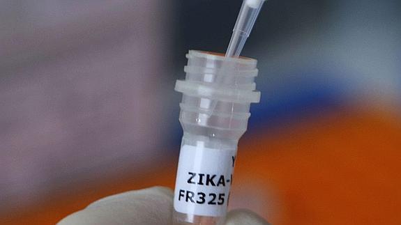 Muestra del virus zika en un laboratorio.