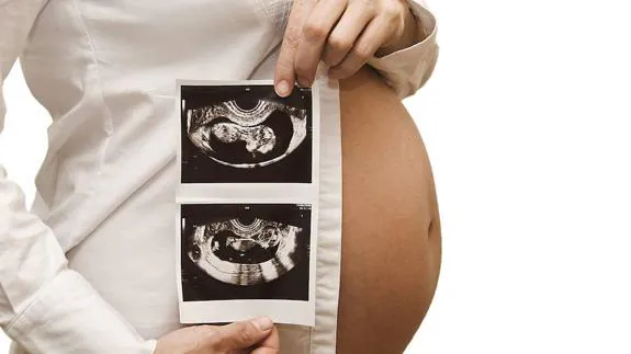 Los embarazos múltiples se producen cuando la mujer es estimulada con dosis elevadas de hormonas o durante más días de los precisos. 