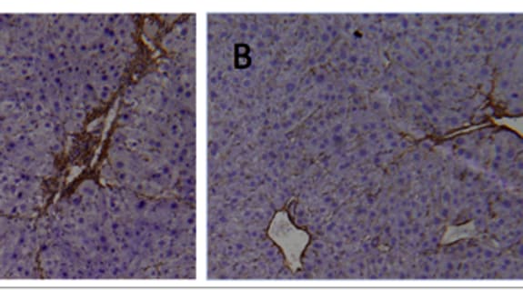 La fibrosis hepática inducida por el tetracloruro de carbono es mucho menor en el hígado de ratones a los que previamente se les administró hormonas tiroideas (B) que en los ratones normales (imagen de la izquierda). La deposición de colágeno está marcada en marrón.