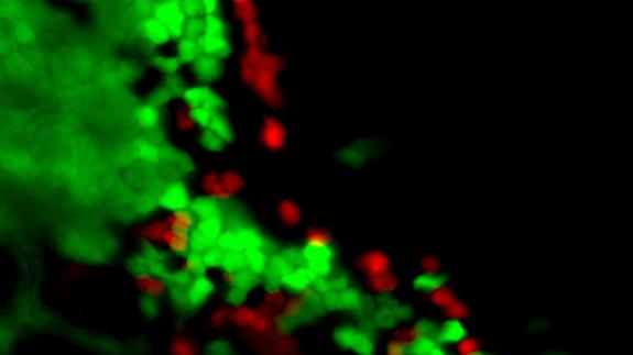 Células madre embrionarias humanas vistas a través del microscopio.