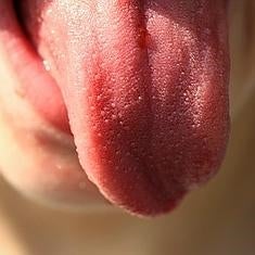 Tratamientos caseros para curar las llagas de la lengua