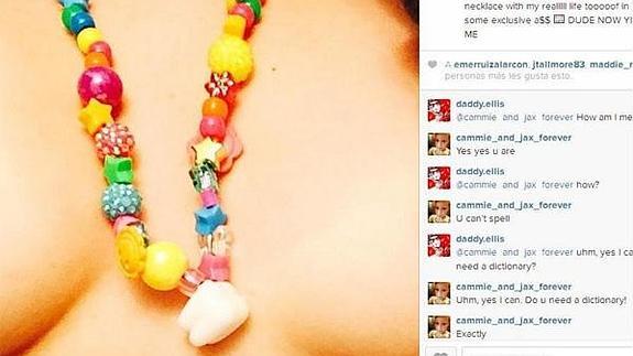 El polémico collarde la muela del juicio de Miley Cyrus.