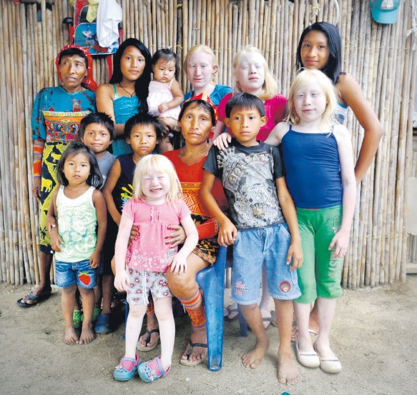 La familia Morales posa ante su casa de Ustupu. Cuatro de las hijas son albinas.