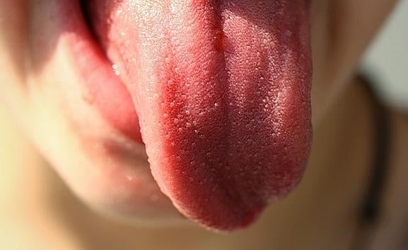 Tratamientos caseros para curar las llagas de la lengua