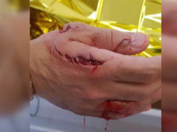 Un tiburón siembra el pánico en una playa de Elche tras morder a un bañista
