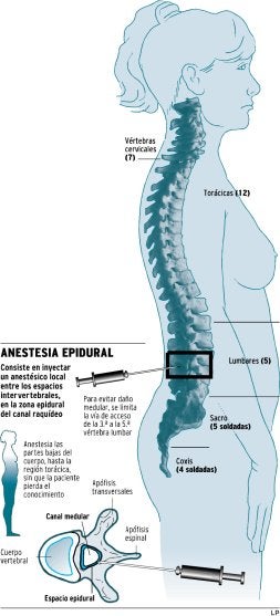Las valencianas siguen sin disponer de epidural si paren de noche o en festivo
