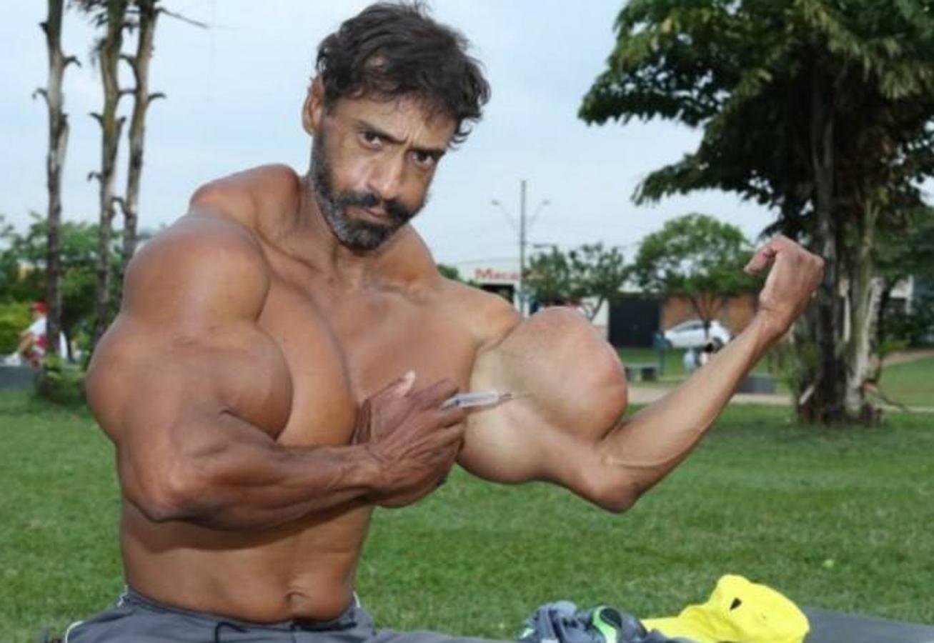 Valdir Segato, el &#039;Hulk&#039; brasileño que se inyecta aceite en los bíceps