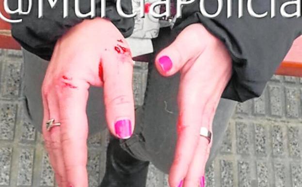 La mujer presentaba heridas en las manos tras ser atacada.