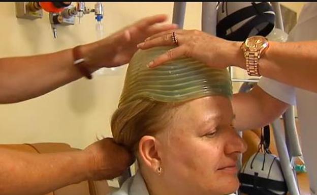 Inventan un casco que evita que se caiga el pelo con la quimioterapia contra el cáncer