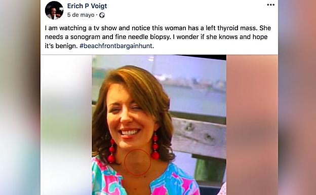 Un médico advierte a una mujer de que tiene cáncer de tiroides tras salir en televisión