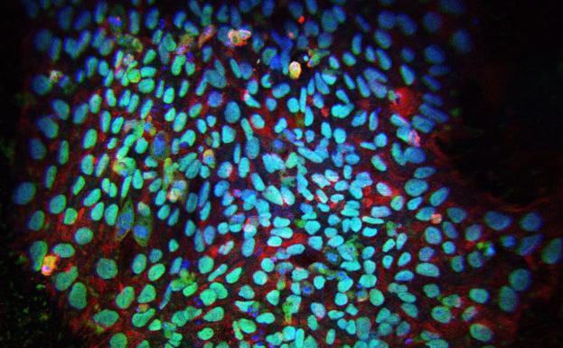 Recreación de una reprogramación de células madre de pluripotencia.