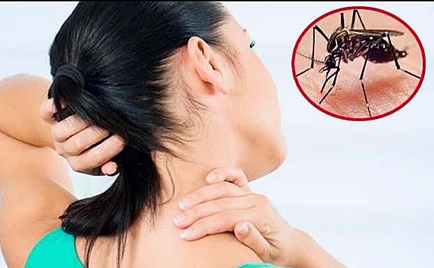 Síntomas y tratamiento del dengue: una fiebre 'quebrantahuesos' que se confunde con una gripe