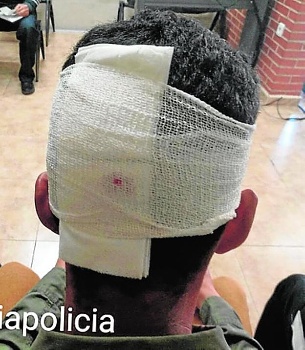 El joven herido en la cabeza. 