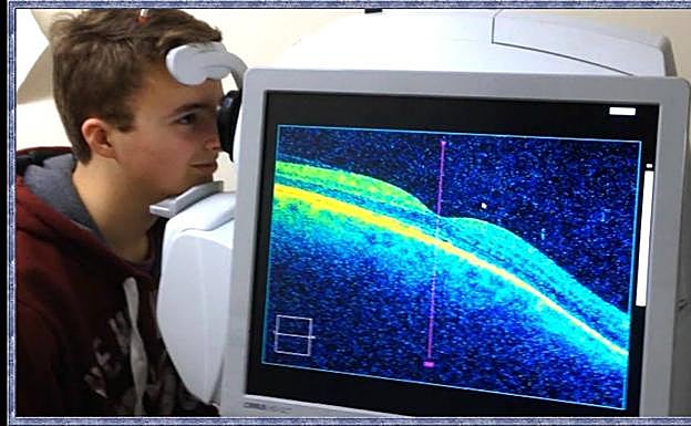 Un joven durante una prueba oftalmológica. 