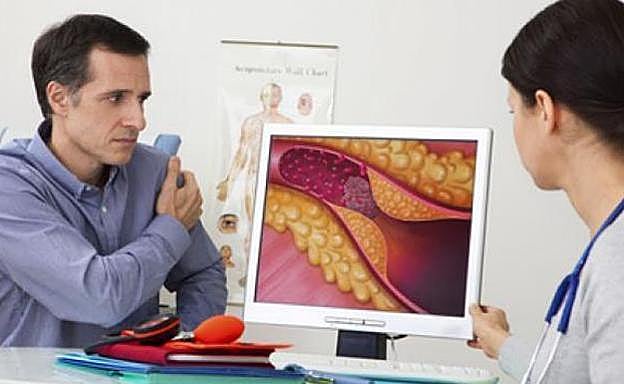 Identifican una proteína clave para mejorar el «colesterol bueno»