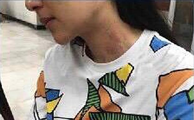 Imagen principal - Tres imágenes del atestado policial donde se puede ver al detenido al entrar al edificio el día de los hechos, las esposas y las marcas en el cuello de la denunciante. 