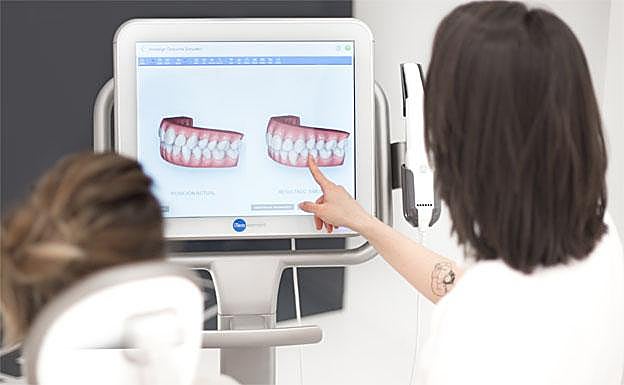El escáner iTero permite conocer, desde el primer día, el resultado del tratamiento de ortodoncia