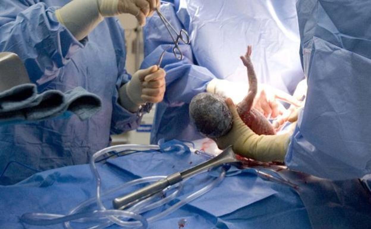 Parto por cesárea en una foto de archivo.