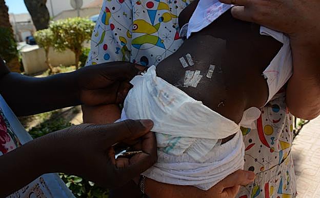 Heridas en la espalda de la niña. 