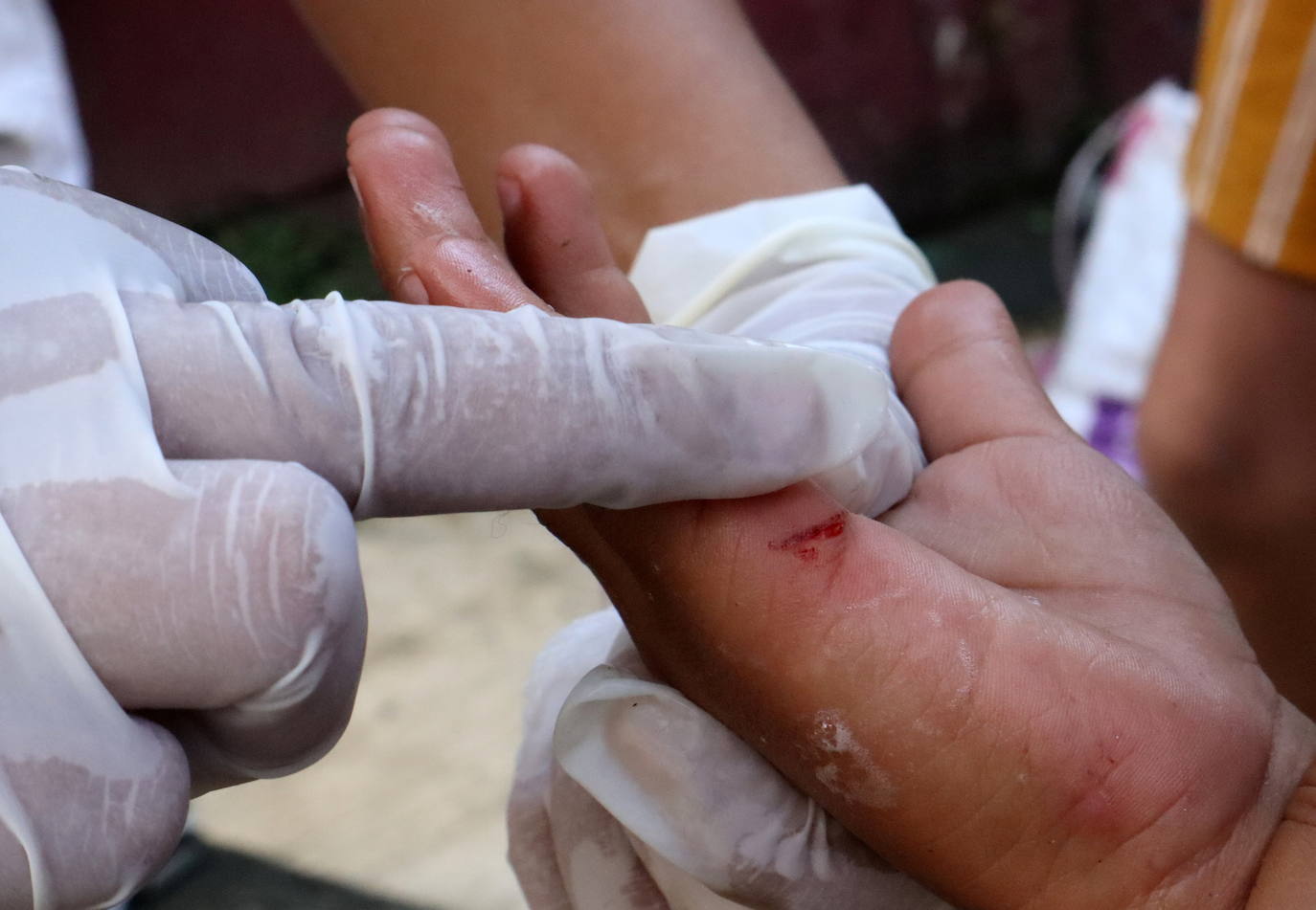 Fotos: Vendas y reposo