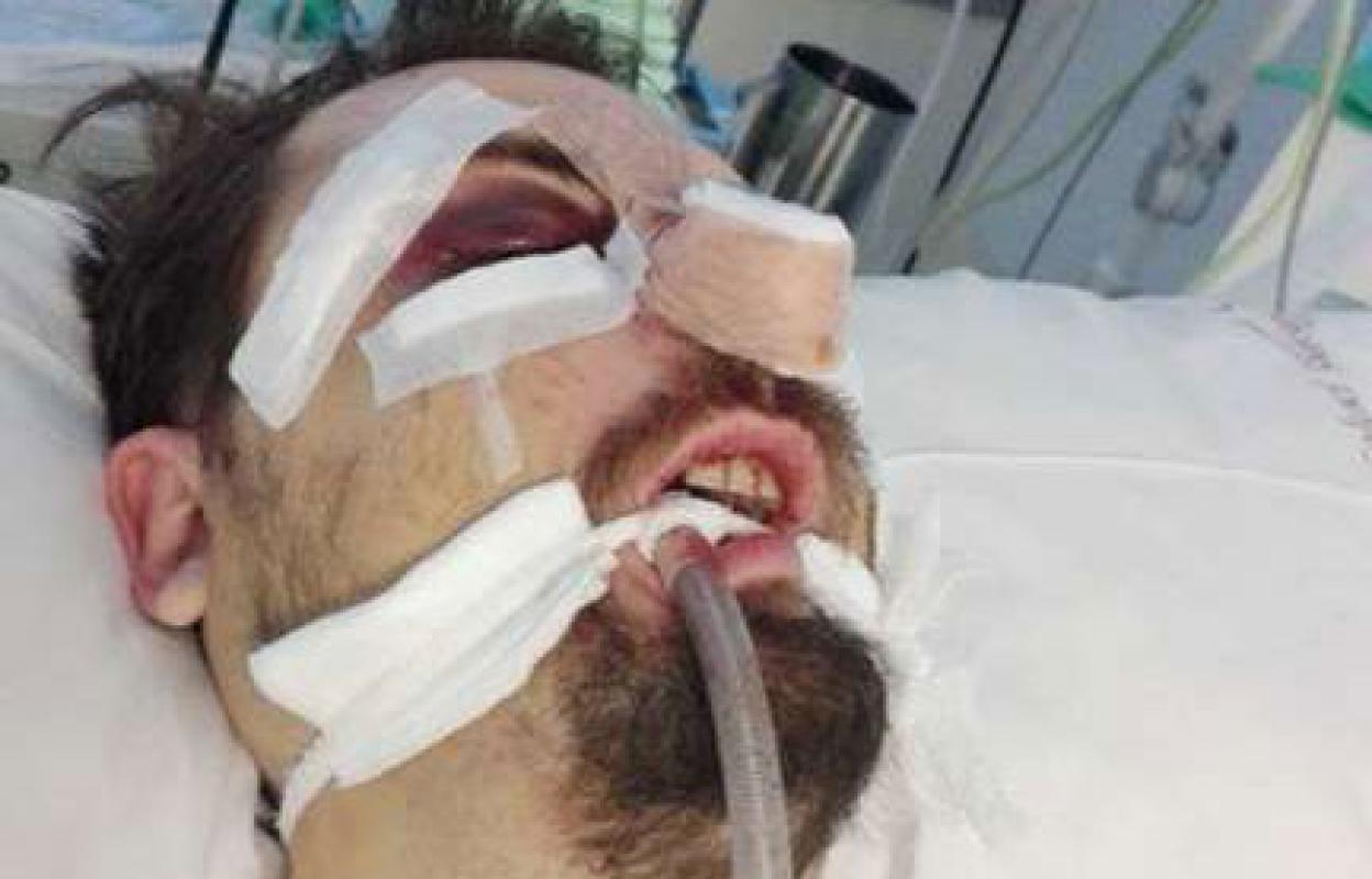 Alejandro, cuando estaba en la UCI. 