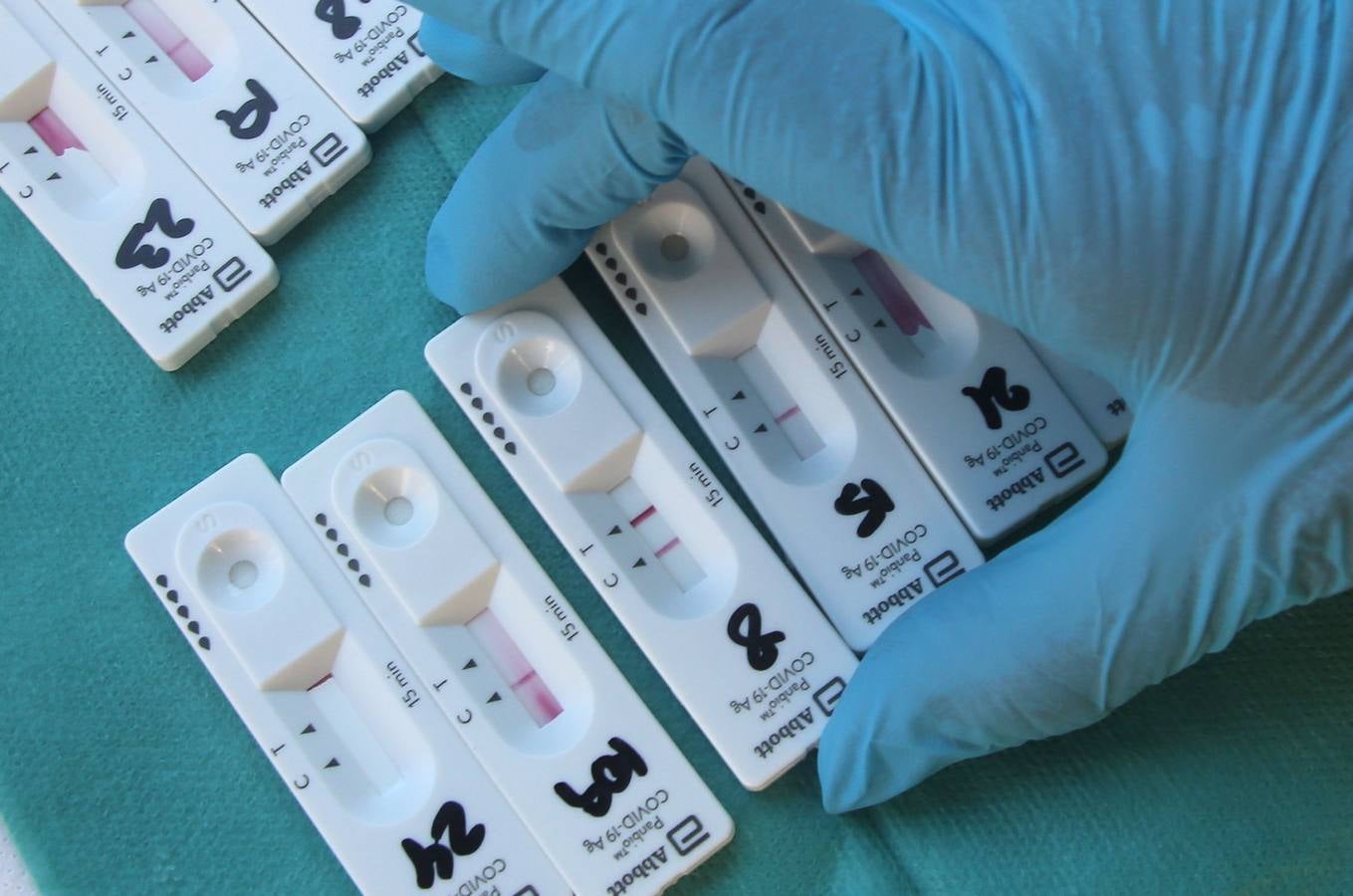 Test para detectar la Covid en una imagen de archivo. 