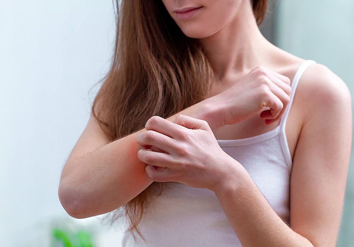 ¿Por qué eres presa de los mosquitos en verano?