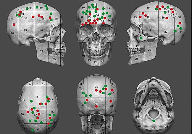 Distribución de las lesiones sanadas (puntos verdes) y de las lesiones no curadas (puntos rojos) en un conjunto de cráneos.