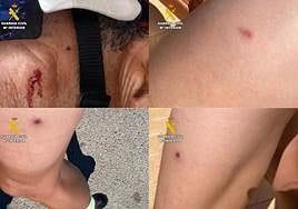 Heridas causadas a los ciclistas.