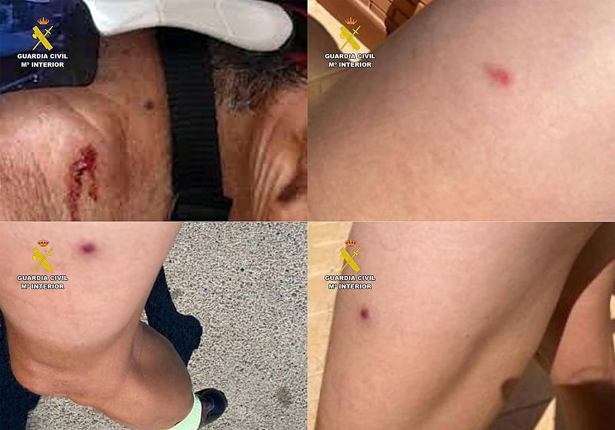 Heridas causadas a los ciclistas.