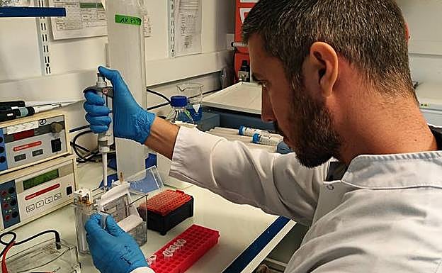 Realización de un 'western blot' para medir la expresión de proteínas involucradas en el metabolismo energético con muestras de hipotálamo de ratón.