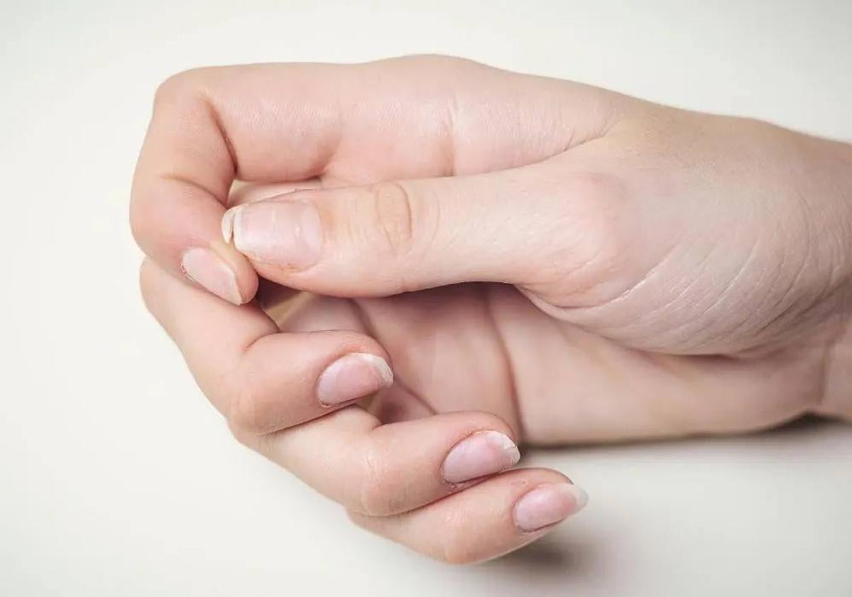 Uñas con manchas y débiles.