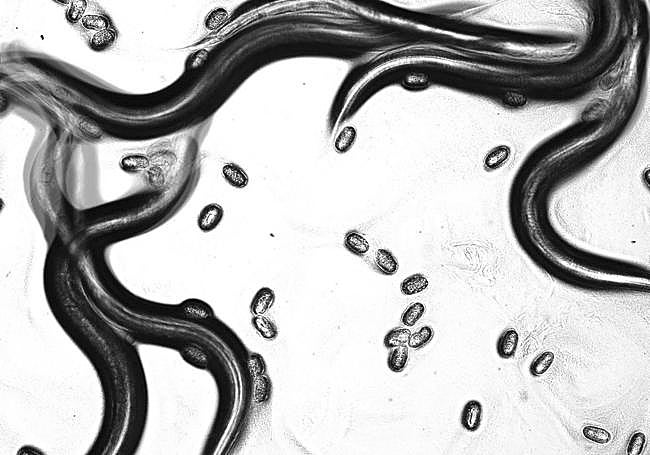 'Caenorhabditis elegans' adulto con huevos.