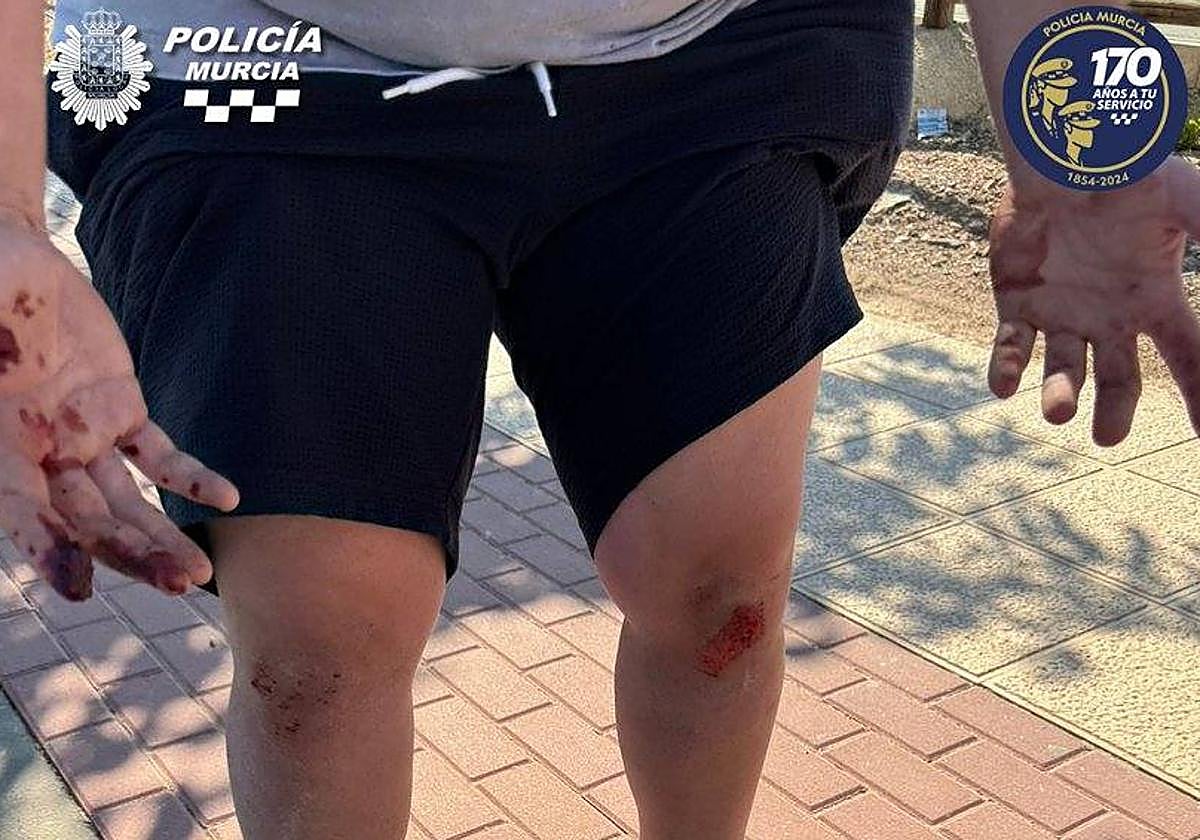 El resultado de la agresión al hombre.