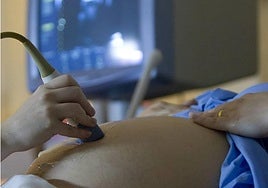 Un sanitario realiza una ecografía a una mujer embarazada.