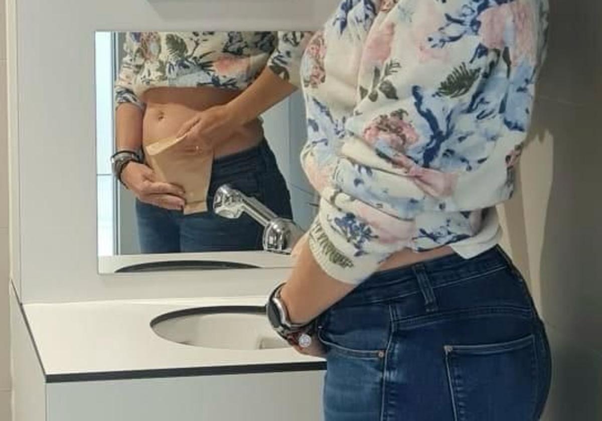 Una mujer va al baño especial para pacientes ostomizados.