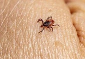 No quites las garrapatas con remedios caseros: una veterinaria revela el método más seguro para evitar infecciones en perros