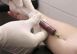No hagas esto antes de un análisis de sangre: cuatro hábitos muy comunes que pueden afectar al resultado.