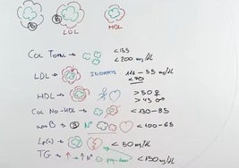 Esquema explicativo realizado por el cardiólogo José Abellán.