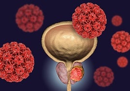 Cristobal Moreno Alarcón Quirónsalud Murcia.