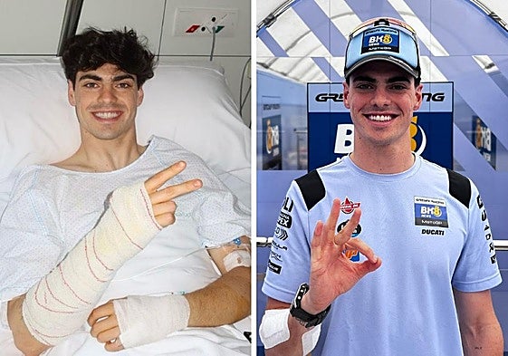 A la izquierda, Aldeguer tras la operación; a la derecha, preparado para el Gran Premio de Italia.