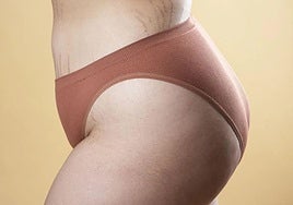 Cuerpo de una mujer con estrías.