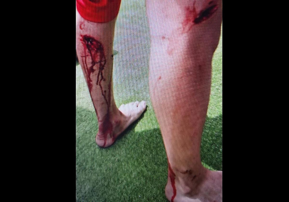 Lesiones causadas por los perros en uno de los ataques, el pasado abril.