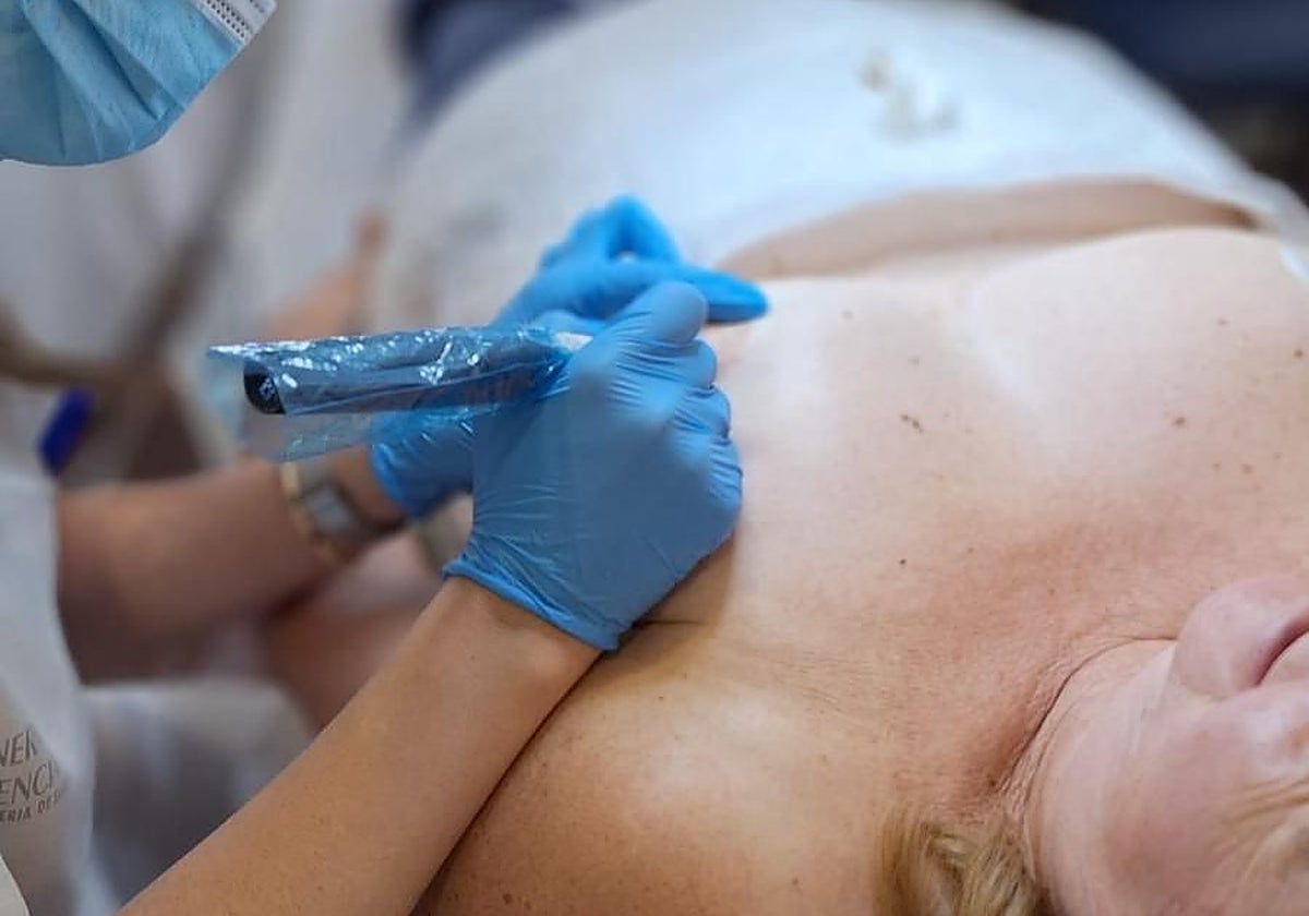 Proceso de micropigmentación mamaria.