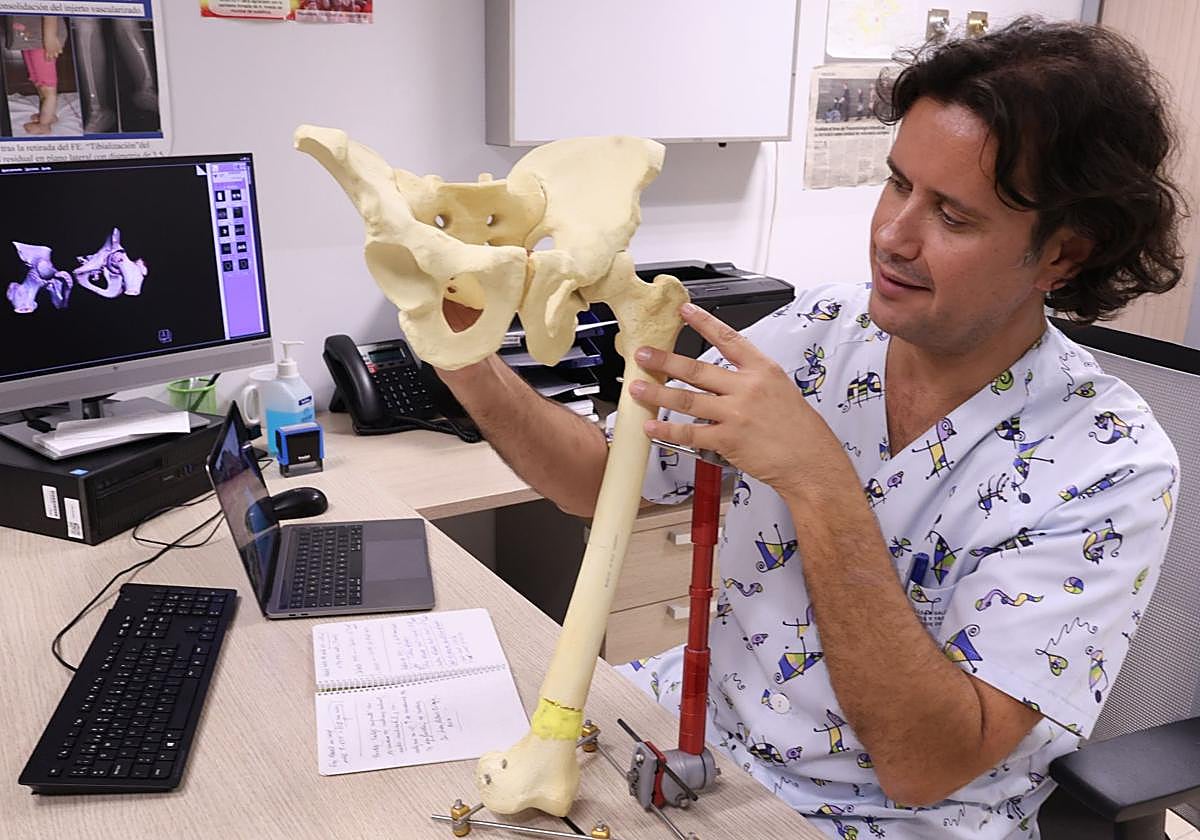 César Salcedo, en su consulta del Infantil de La Arrixaca, explica las características de la enfermedad ayudado de sendos modelos de un fémur y una cadera.