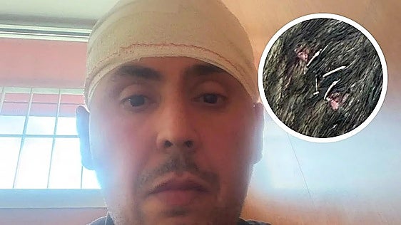 El acusado de la presunta agresión racista a un vecino de Bullas asegura que iba muy drogado